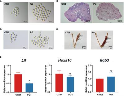 Transcriptome profiling reveals superovulation with the gonadotropin-releasing hormone agonist trigger impaired embryo implantation in mice